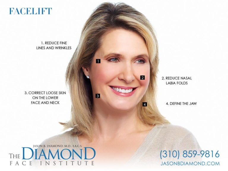 Best Beverly Hills Facelift | Beverly Hills Facial Surgeon Dr. Jason ...